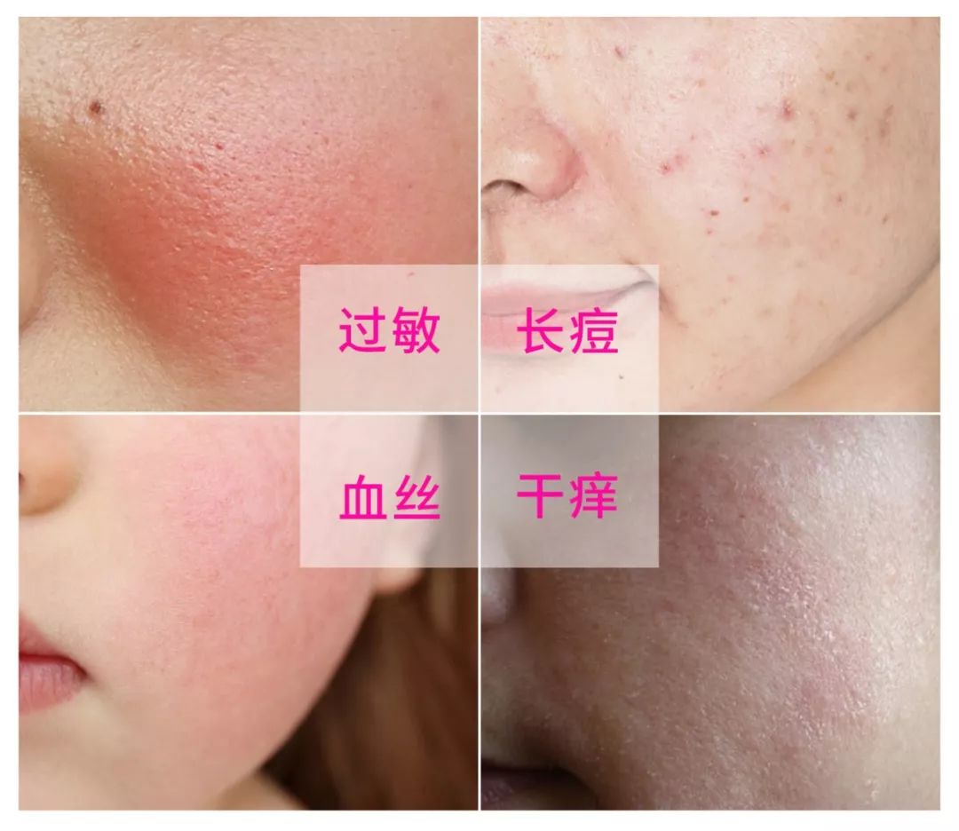 厚皮老脸，生肖背后的文化解读与现代应用