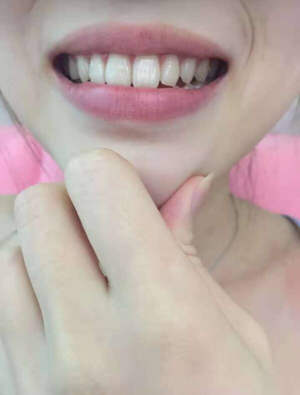 红口白牙打一最佳生肖、独特解释落实