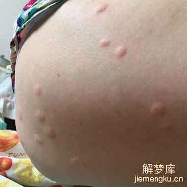 疙里疙瘩代表什么生肖:词语解析解答落实