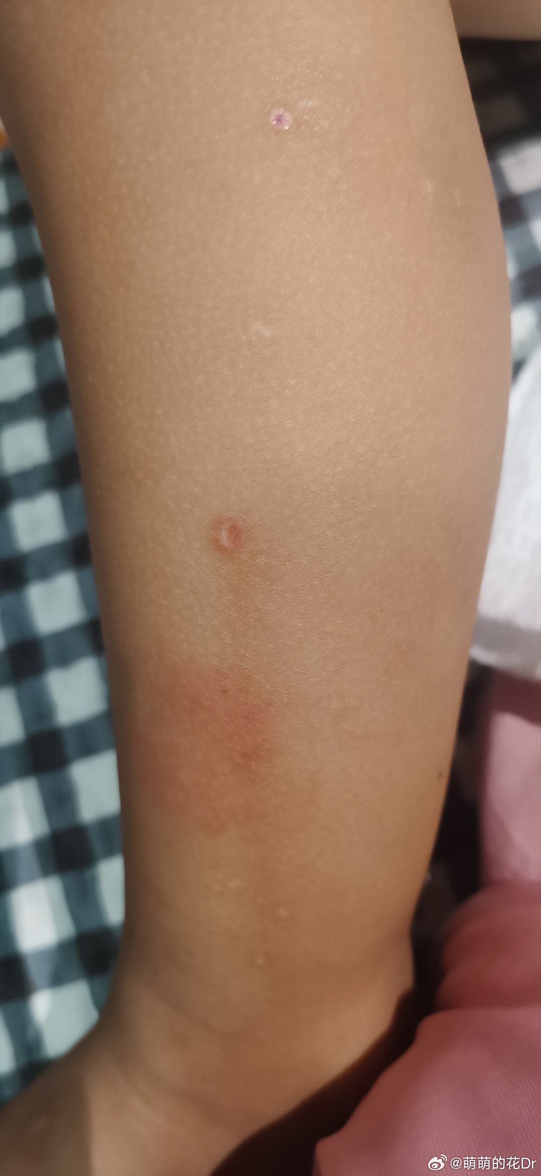 疙里疙瘩代表什么生肖:词语解析解答落实