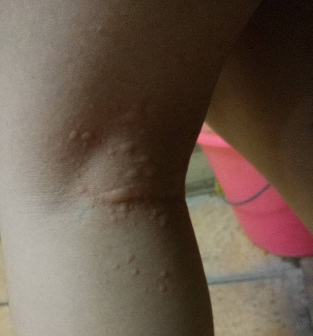 疙里疙瘩代表什么生肖:词语解析解答落实