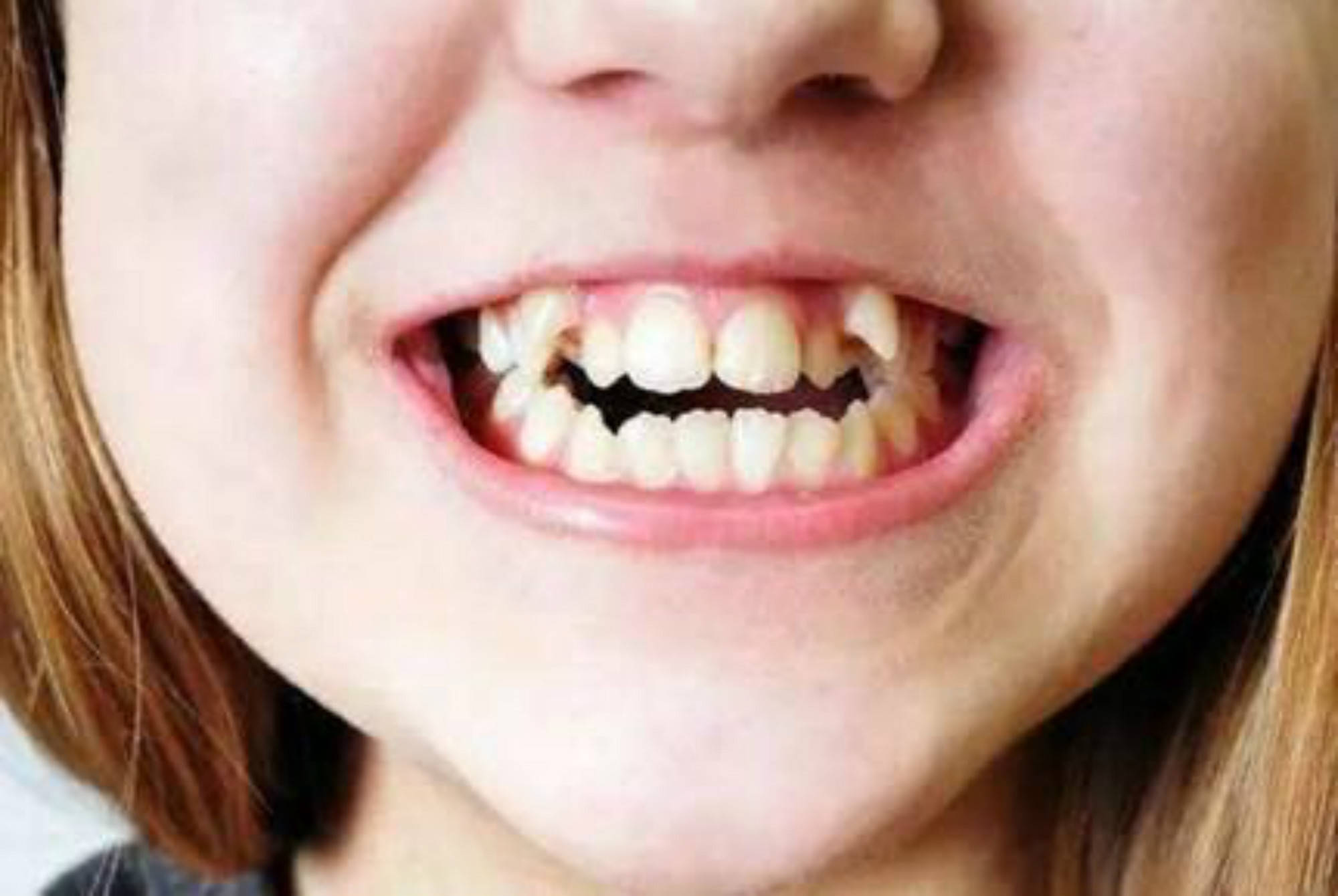 咬紧牙根的意思:词语解析解答落实